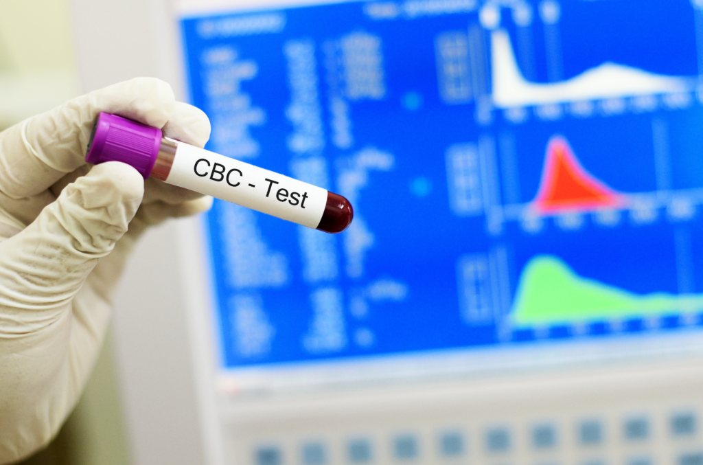 A gloved hand holding a vial labeled ‘CBC - Test’ in front of a CBC machine displaying various graphs and charts.
